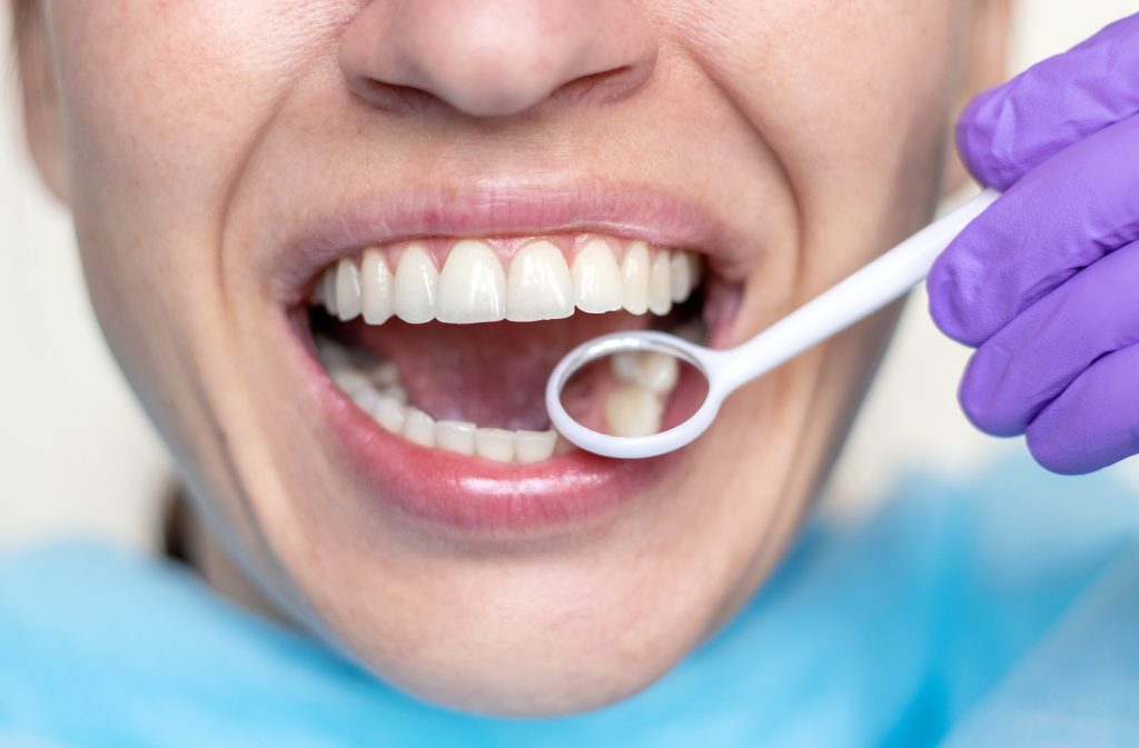 Kompleksowe leczenie zębów – czym jest i jak przebiega?